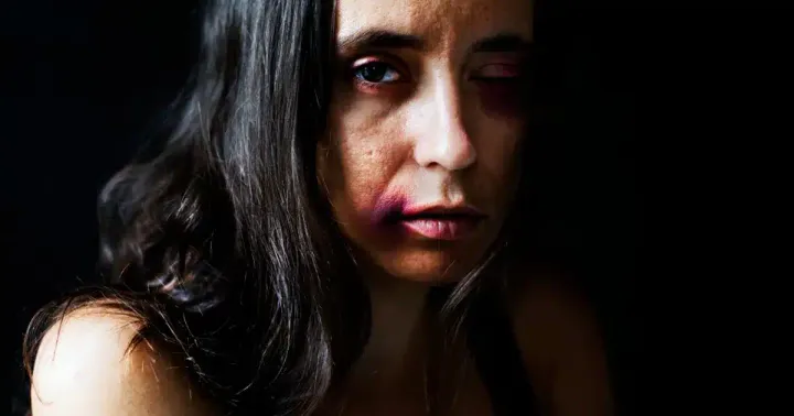 Mulher com marcas de agressão no rosto olha para a câmera